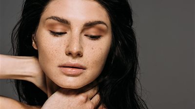 هل يزعجكِ النمش؟ .. إليكِ الحلول التي ستغير بشرتك بخطوات بسيطة