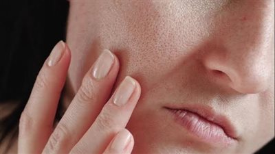 جفاف البشرة في رمضان 2025.. أفضل الماسكات الطبيعية للترطيب