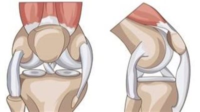 طرق علاج المفاصل.. خيارات متعددة لتخفيف الألم وتحسين الحركة