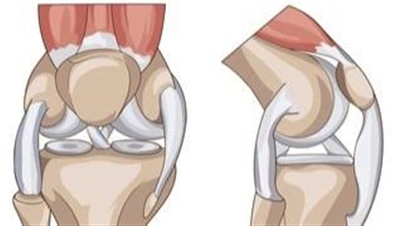 طرق علاج المفاصل
