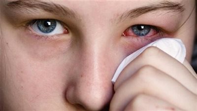 أعراض وأسباب التهابات العين في فصل الشتاء 