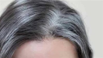 تخلص من الشيب نهائيا بزيت جوز الهند والليمون .. شعر أسود ولامع 