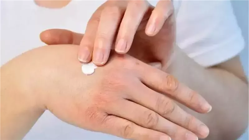 اليدين
