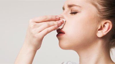 أسباب وطرق علاج نزيف الأنف بالمنزل.. ومتى يدل على حالة صحية خطيرة؟