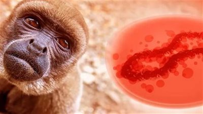 تفشي جدري القرود في الصين .. كيف يتم انتقاله وطرق الوقاية منه؟