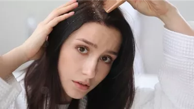 وصفات طبيعية للتخلص من قشرة الرأس.. اللبن الرائب وبذور الحلبة الأبرز