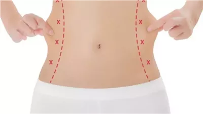  رحلة نحت القوام التي انتهت بوفاة تيك توكر شهيرة.. إليكِ مخاطرها