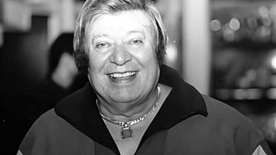 ميمي الشربيني والزهايمر.. كيف يتسبب المرض في تدهور صحة المريض؟