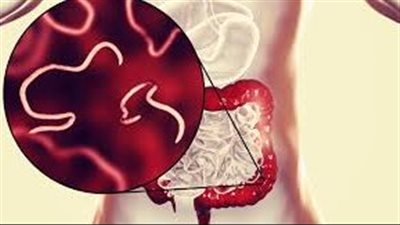 أعراض ومضاعفات عدوى الديدان الدبوسية لدى البالغين