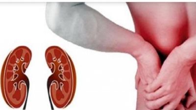 أبرزها المسكنات.. ما هى أسباب الفشل الكلوي؟