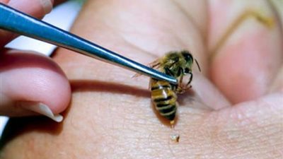 أسرار لا تنتهي عن العلاج بقرص النحل.. تعرف عليها