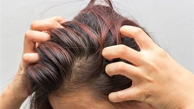 هل تعاني من حكة فروة الرأس؟ إليك كل ما تحتاج لمعرفته