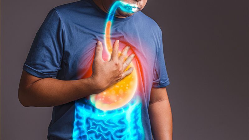 علاج إرتجاع المرئ