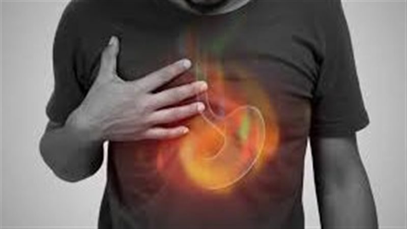أسباب وعلاج حرقة