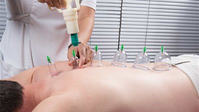 ماذا نأكل بعد الحجامة؟.. نصائح غذائية لتجنب الأعراض الجانبية