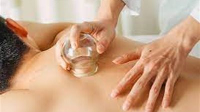 ما هو حكم الحجامة للصائم في رمضان .. هل تؤثر على صحة الصيام؟