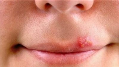 نصائح هامة للتغلب على جفاف الفم ونشفان الريق في رمضان 2025