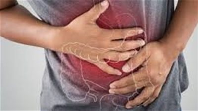 كيف تتجنب الاضطرابات الهضمية في العيد؟.. نصائح لمرضى القولون