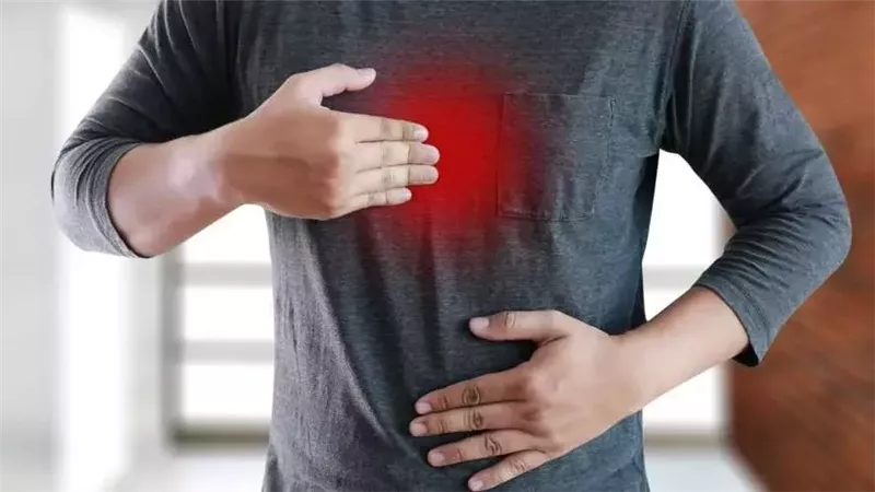 علاج حرقة المعدة
