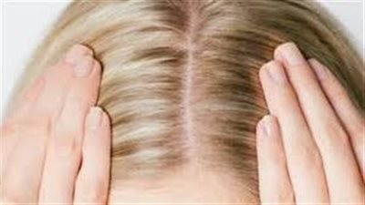 وصفة طبيعية لتنظيف فروة الرأس والتخلص من القشرة بشكل فعال وآمن