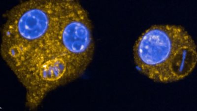 منظمة الصحة العالمية تدق ناقوس الخطر: بكتيريا قاتلة  تهدد حياة الملايين