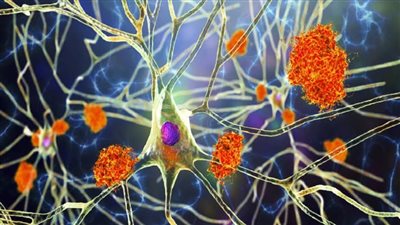 مفاجأة مدوية.. نبته الصبار تحمل أملاً جديدًا لمرضى ألزهايمر 