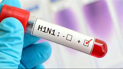 مستشار رئيس الجمهورية لشؤون الصحة يكشف نوع فيروس الإنفلونزا المنتشر في مصر