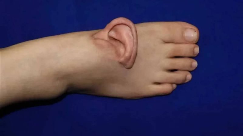 معجزة طبية تهز العالم