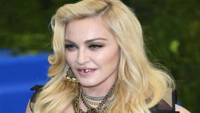 مادونا لا تكف عن إغراء جمهورها رغم إصابتها في ركبتها
