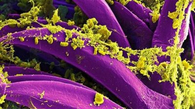 أشدها خطورة «الرئوي».. هذه أنواع الطاعون