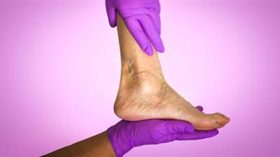 أبرزها النقرس.. هذه الأسباب وراء آلام القدمين