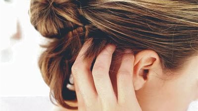 كيف تعالج حكة فروة الرأس ب 5 طرق
