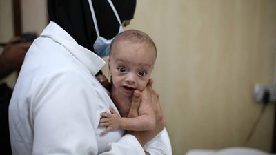 كارثة إنسانية ستحدث قريباً ..  كورونا يتسبب في موت الكثير من الجوع