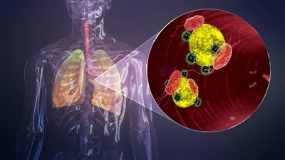 عاجل.. لجنة الفيروسات تكشف أعراض غير متوقعة لمصابي فيروس كورونا