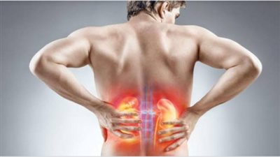 لمنع تكرار الإصابة بحصوات الكلى إليك هذه النصائح