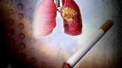 خلى بالك.. عادات خاطئة تسبب انسداد الرئة